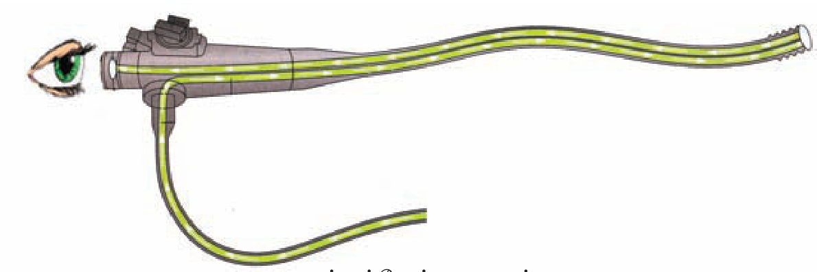 படம் 5.13 — Fiber optic நார்த்திரள் — ஒளி TIR-ஆல் நார்வழி.